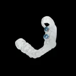 Guia Cirúrgico para Implante Dento Suportado