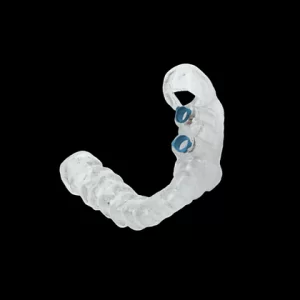 Guia Cirúrgico para Implante Dento Suportado