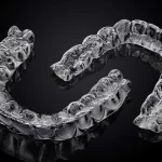 Alinhador Ortodôntico