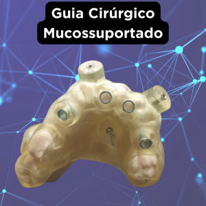 GUIA CIRÚRGICO PARA IMPLANTE MUCOSSUPORTADO