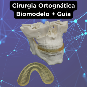 CIRURGIA ORTOGNÁTICA – GUIA + PLANEJAMENTO VIRTUAL