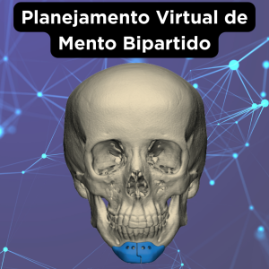 PRÓTESE FACIAL CUSTOMIZADA