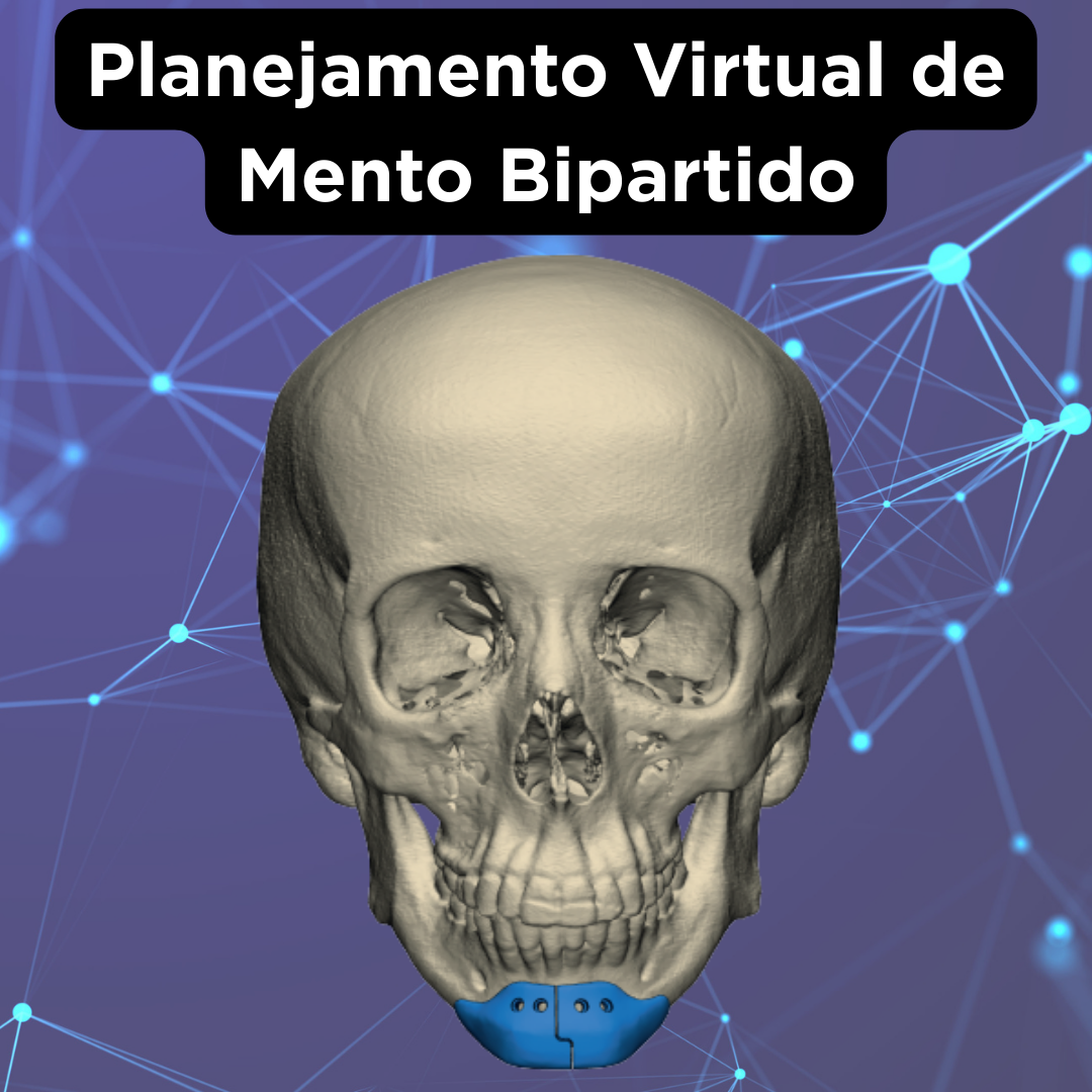 PRÓTESE FACIAL CUSTOMIZADA