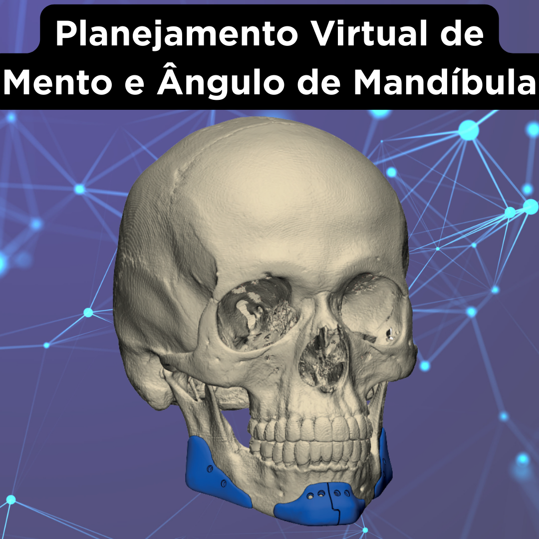 PRÓTESE FACIAL CUSTOMIZADA - Image 3