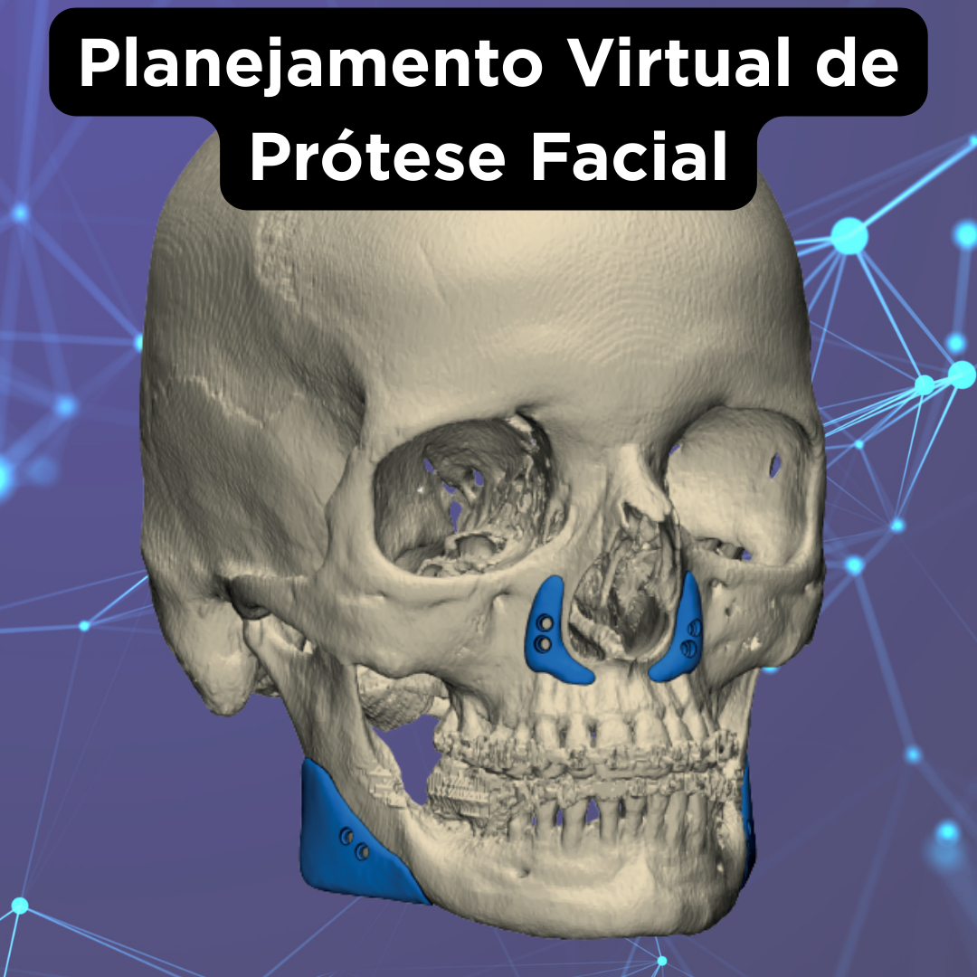 PRÓTESE FACIAL CUSTOMIZADA - Image 4