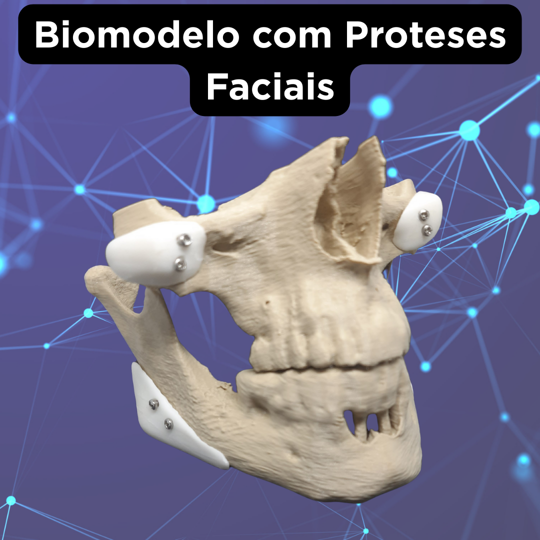 PRÓTESE FACIAL CUSTOMIZADA - Image 5