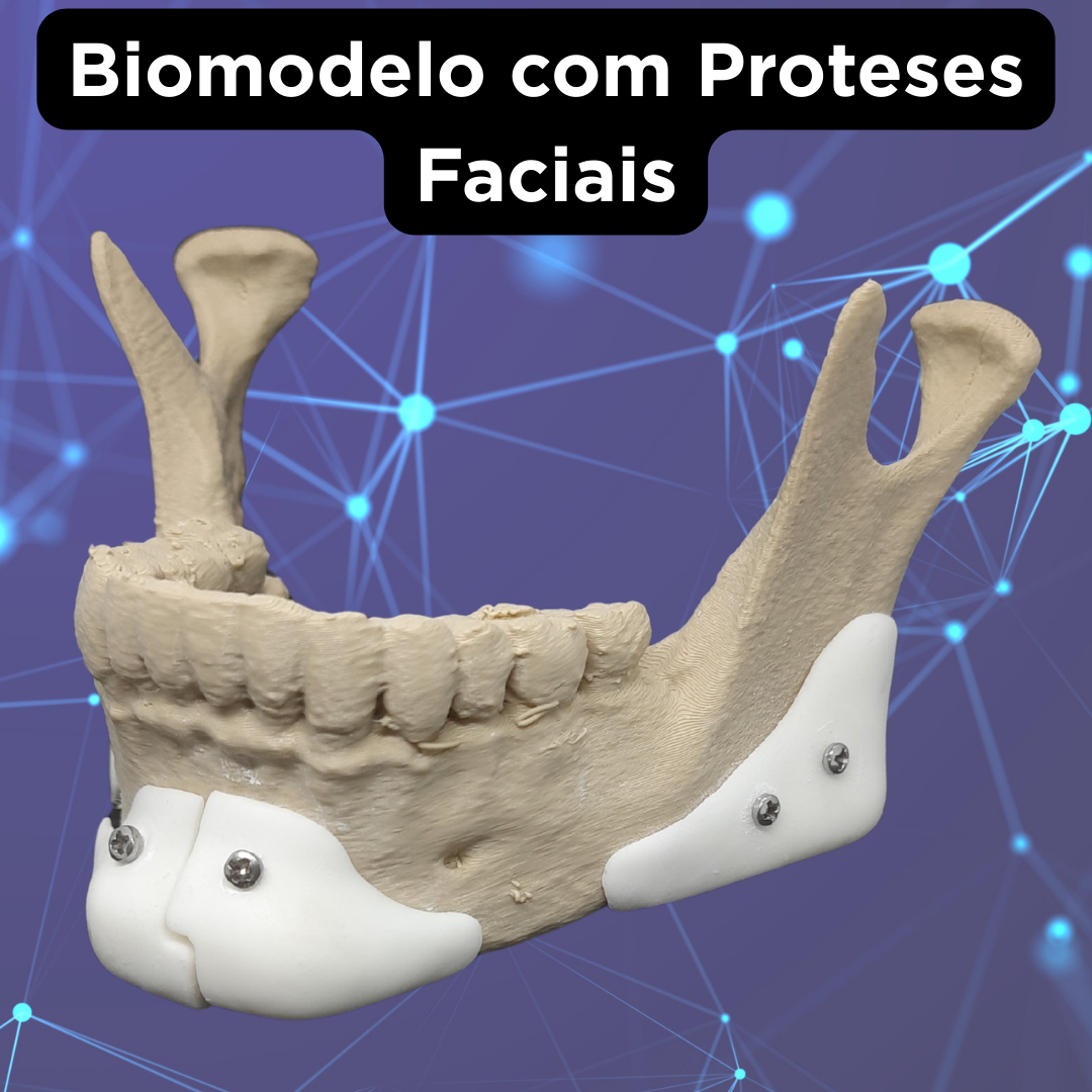 PRÓTESE FACIAL CUSTOMIZADA - Image 6