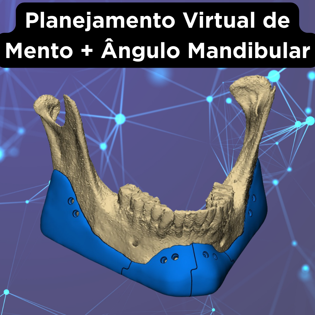 PRÓTESE FACIAL CUSTOMIZADA - Image 7