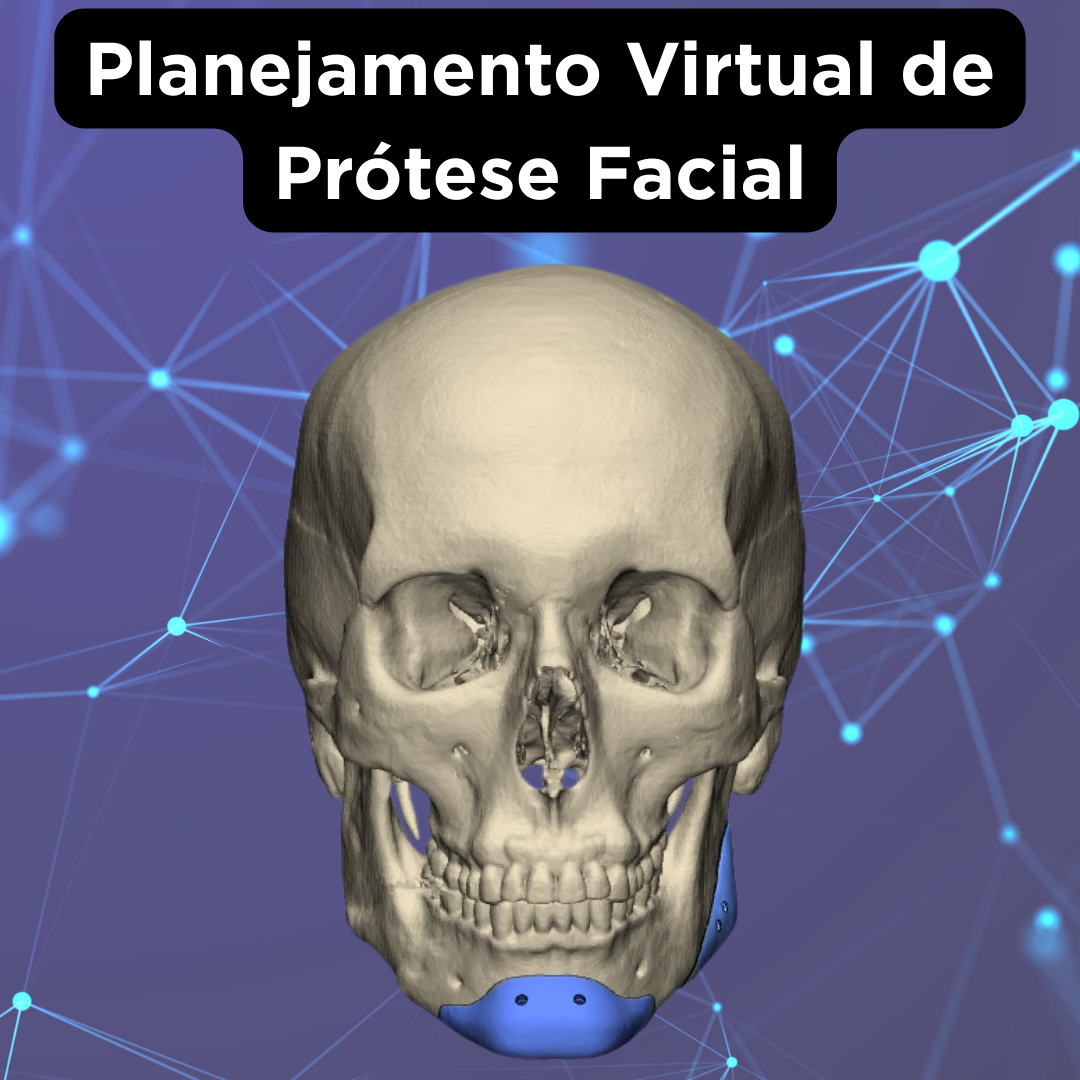 PRÓTESE FACIAL CUSTOMIZADA - Image 8