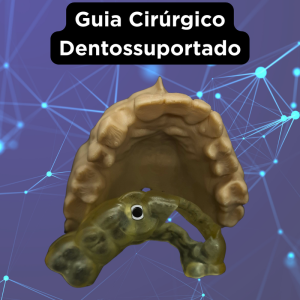 GUIA CIRÚRGICO PARA IMPLANTE DENTOSUPORTADO
