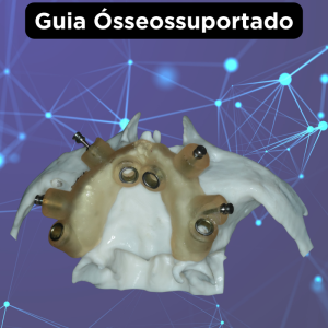 GUIA CIRÚRGICO CUSTOMIZADO