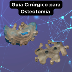 GUIA CIRÚRGICO PARA IMPLANTES COM OSTEOTOMIA